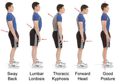 Visual representation of muscle imbalances